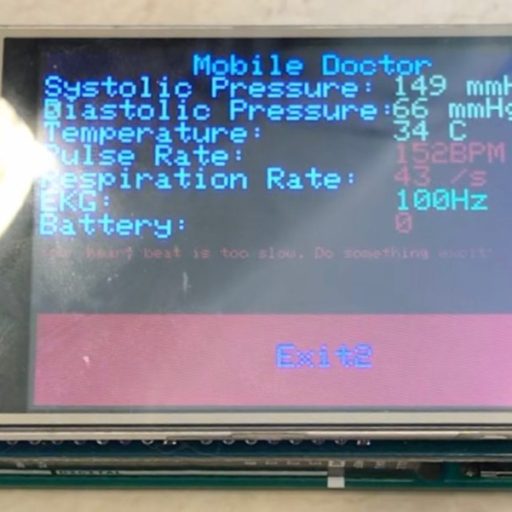 (Arduino MEGA, Arduino UNO) A real-time system for monitoring and displaying (TFT) patients’ vital activities including pulse rate, respiration rate, EKG and etc. (Click to see more)